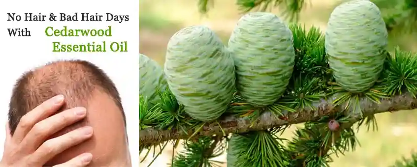 End Your No Hair & Bad Hair Days With Cedarwood Essential Oil